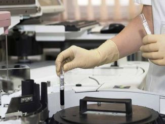 Laboratuvar Elemanı Nedir, Ne İş Yapar, Nasıl Olunur? Laboratuvar Elemanı Maaşları 2022 - OtonomHaber